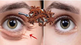 Even at 90 years old, you'll look younger using parsley/anti-aging collagen