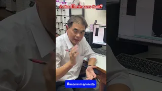  อาการปวดต้นคอที่เกิดจากหมอนรองกระดูกเคลื่อนออกมานิด ๆ และกดเส้นประสาท มีวิธีการรักษาอย่างไรบ้าง 