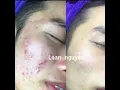 Loan Nguyen 1
