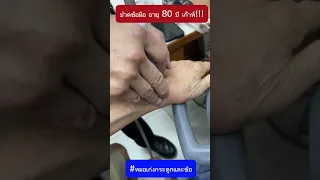  ทำไมคนไข้อายุ 80 ถึงมีอาการปวดข้อมือและบวมแดงอย่างรุนแรง 