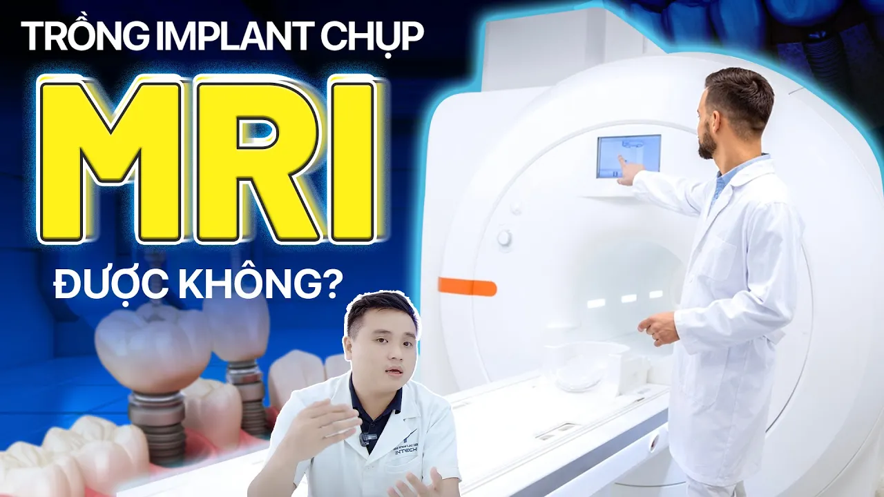 Outline Video Trồng Răng Implant Có Chụp MRI Được Không? Không Thể Chụp Cộng Hưởng Từ MRI Nếu Gặp Tình Huống Này!