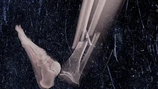 a grandma ate cookie dough for lunch every week this is what happened to her bones