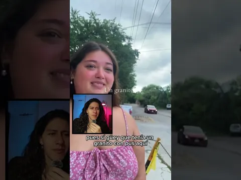 POV: lo besé y tenía un granito 😂