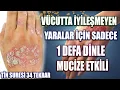 Download Lagu Vücutta iyileşmeyen yaralar için sadece 1 Defa Dinle ( Hastaya okunacak dua, Tin suresi fazileti)