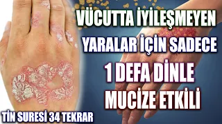 v cutta iyile meyen yaralar i in sadece 1 defa dinle hastaya okunacak dua tin suresi fazileti 