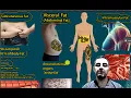 Intramuscular Fat vs Other Body Fats Key Differences How to Reduce Intramuscular Fat