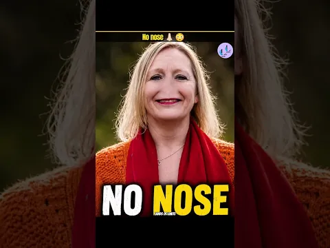 no nose 👃