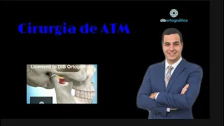 Cirurgia da ATM ,como é feito o  reposicionamento do disco articular .