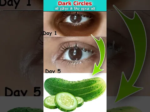 Best remedy for dark circles #beauty #shorts
