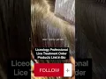 Download Lagu Removing lice from dark hair #lice #piojos # #nitpicking #hair