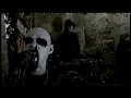 Download Lagu SARKOM - Inferior bleeding