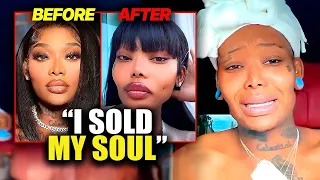 Summer Walker Breaks Down Over Botched Plastic Surgery Reveals Industry Destroyed Her
