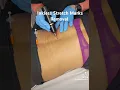 Inkless Stretch Marks Removal