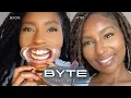 Fixing my TEETH Affordable Aligners to Straighten Teeth My Byte Journey Update iamLindaElaine