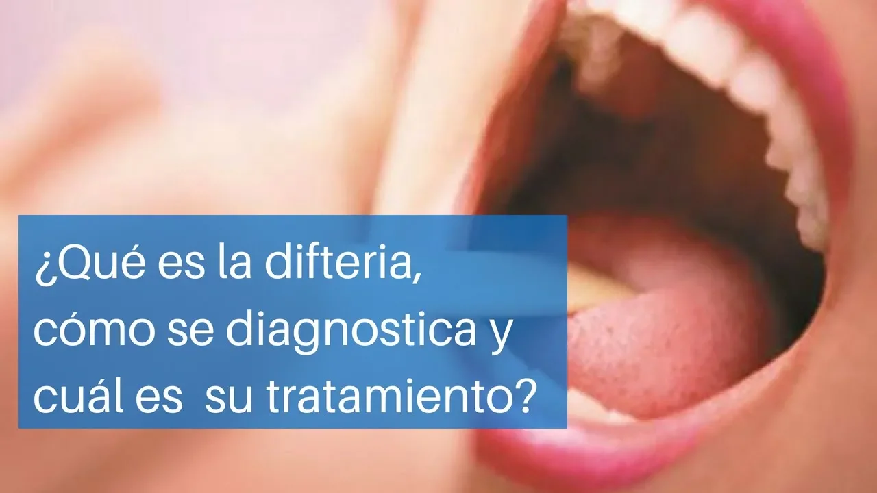 ¿Qué es la difteria, cómo se diagnostica y cuál es su tratamiento?