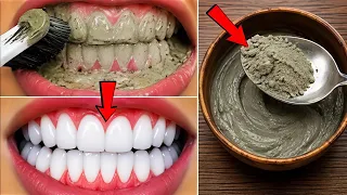 सिर्फ 1 मिनट में गंदे दांतों को मोती की तरह चमका देगा यह घरेलू नुस्खा Teeth Whitening Remedy