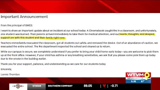 Student burned after Chromebook caught fire