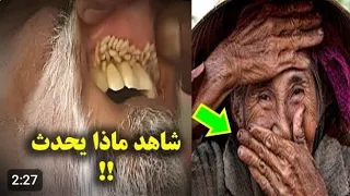 رجل يخرج من أسنانه دود انظر ماذا فعل