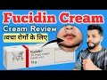 Download Lagu Fucidin Cream Review In Hindi 🔥 Fusidin Acid Uses And Side Effects