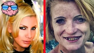 Download Top 10 Shocking Before And After Drug Use Photos MP3