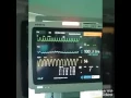 Download Lagu Ngeri liat monitor pasien bgini , pasien yg mauuu......