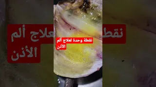 وصفةمجربة و فعالة للكبار والصغار للتخفيف من ألم الأذن  وصفةمجربة و فعالة للكبار والصغار للتخفيف من ألم الأذن
