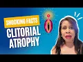Shocking Facts about Clitoral Atrophy