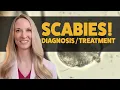 SCABIES DIAGNOSIS TREATMENT CAUTIONARY TIPS from a Dermatologist