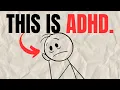 Every AD Symptom EXPLAINED in 12 Minutes