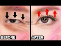 Lagu 28 min🔥 Anti-Aging Eye Lifting Massage For Eye Bags, Sunken Eyes, Bigger Eyes, Dark Circles