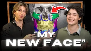 My Friend Got 10 Facial Surgeries INTERVIEW