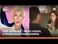 Lagu “Ken Humano” enfrenta dificuldades; com novo visual, veja como rapaz está | #AloVoce