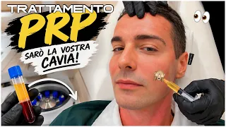 TORNATO A MILANO PER UN EVENTO SUPER ✨ e TRATTAMENTO PRP cos’è? 😰 | Vlog