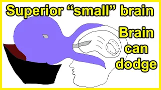 Small brain superiority