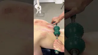 LOUD CRACKS Steamrolling A Tight Back