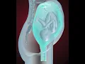 Download Lagu Fetus coming in to birth position (3D Animation)