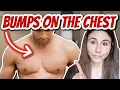 A Dermatologist s Guide To Understanding And Treating Bumps On The Chest That Are Not Acne