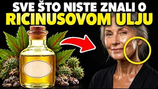 12 iznenađujućih načina upotrebe RICINUSOVOG ULJA ! OVO vam niko neće reći