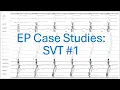 SVT Case Study #1