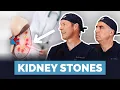 Do You Have A Kidney Stone Diagnosis Treatment And How To Prevent Them