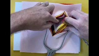 Open inguinal hernia repair - whistle stop