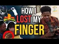 How Walter Jones lost a finger