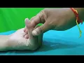 littel finger PIP Joint stiffness Examination