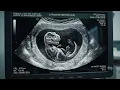 Dino fake ultrasound