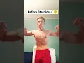 Download Lagu Before and After Steroids💉😳#gym #shorts #bodybuilding #steroids #trending