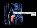 Painful Thigh Lump Common Causes and When to Seek Medical Care BuoyHealth com