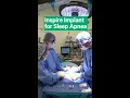Download Lagu Inspire Implant for Sleep Apnea