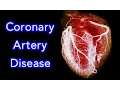 Coronary Artery Disease CAD Animation - MADE EASY