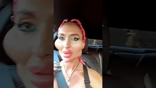 عجیب ترین جراحی های صورت ناموفق که تا به حال ندیدین    دندنها