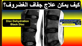 جفاف غضاريف العمود الفقري بين المرضي والفسيولوجي وهل يمكن علاجه مع خبير علم الحركة د عدنان السمرمد  جفاف غضاريف العمود الفقري بين المرضي والفسيولوجي وهل يمكن علاجه مع خبير علم الحركة د عدنان السمرمد
